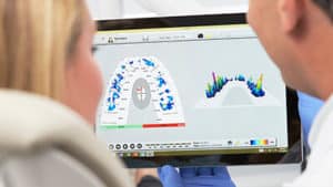 tscan Bite Analysis